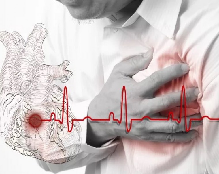 Механизмы и причины внезапной сердечной смерти. Факторы и стратификация риска в клинической практике. Основные определения и термины