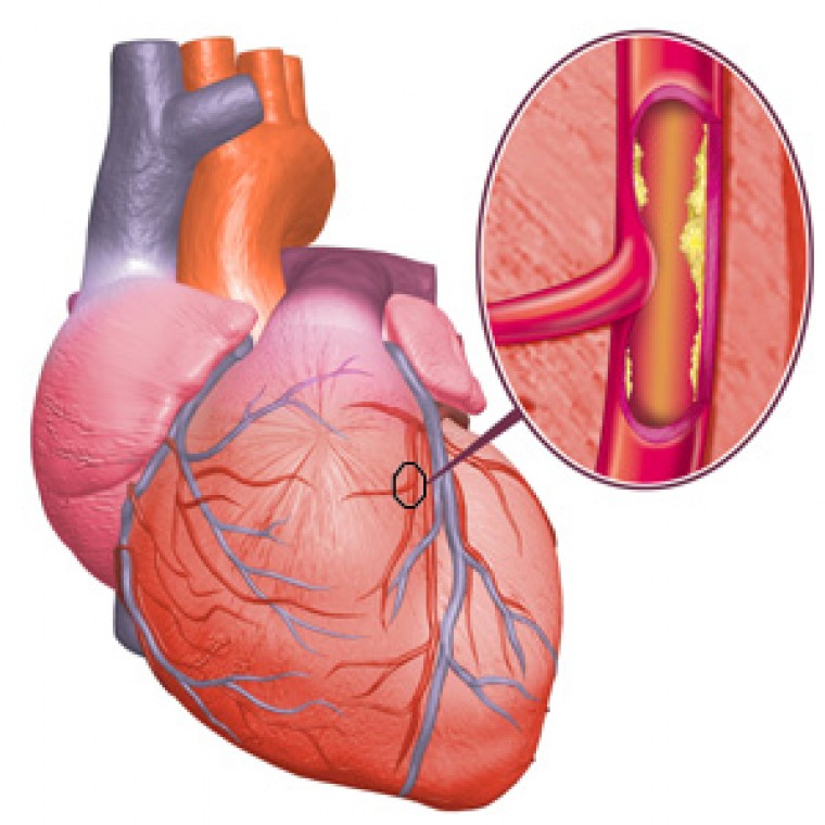 Структура пула свободных аминокислот и их производных плазмы крови у пациентов с ишемической болезнью сердца и проявлениями хронической сердечной недостаточности