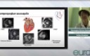 Конференция The Hypertrophic cardiomyopathy (HCM) in the general cardiologist’s daily practice 30 октября
