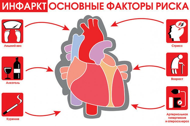 Проблемы традиционного подхода к прогнозированию риска ишемической болезни сердца