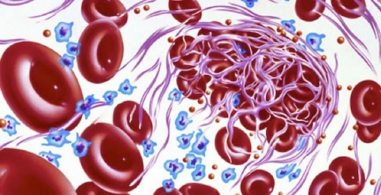 Эволюция применения «новых» пероральных антикоагулянтов при тромбоэмболии легочной артерии