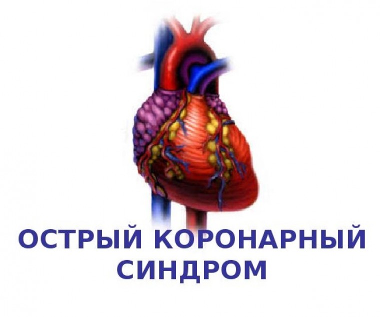 Особенности организации оказания медицинской помощи пациентам с острым коронарным синдромом в ростовской области 
