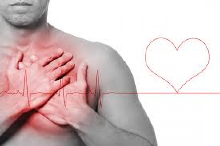 Лечение стабильной ишемической болезни сердца: имеет ли коронарное стентирование превосходство над медикаментозной терапией?