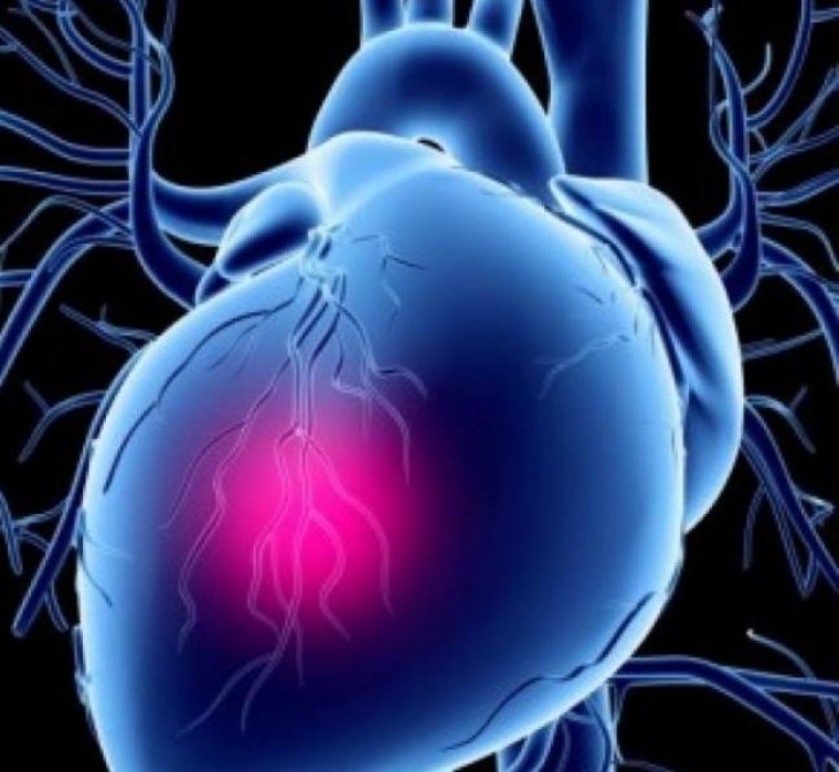 Кардиогенный шок при остром инфаркте миокарда - потери и достижения
