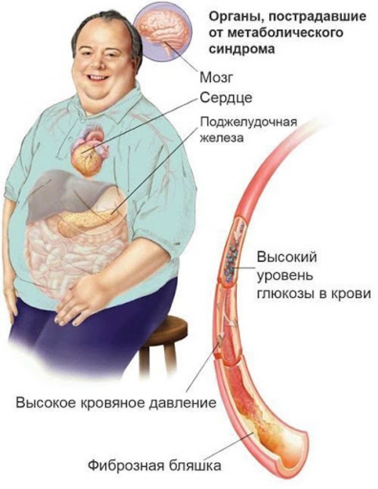 Структурно-функциональное состояние сердечно-сосудистой системы у беременных с метаболическим синдромом