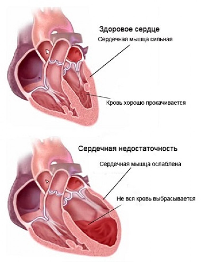 Диагностические возможности и прогностическое значение циркадных параметров вариабельности сердечного ритма у пациентов с хронической сердечной недостаточностью
