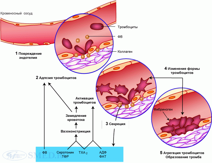 Особенности тромбоцитарного гемостаза у пациентов с разной чувствительностью к антитромбоцитарной терапии при стабильной стенокардии напряжения после планового чрескожного коронарного вмешательства
