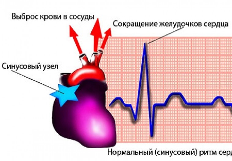 Вариабельность сердечного ритма и выбор сенсора частотной адаптации у пацинтов с синдромом бради-тахикардии