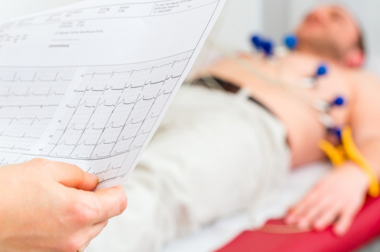Редкие случаи гипертрофической кардиомиопатии: варианты и клинические наблюдения