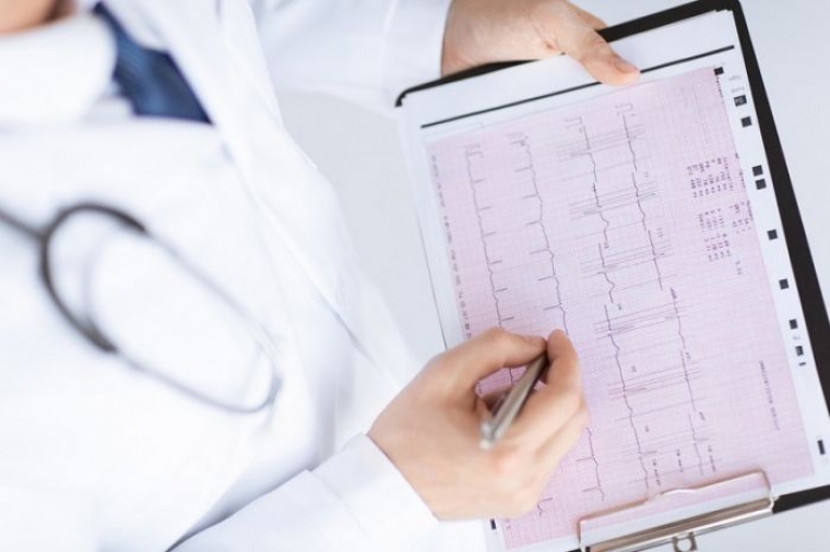 Характеристика аритмического синдрома у пациентов с неклапанной фибрилляцией предсердий на фоне ишемической болезни сердца